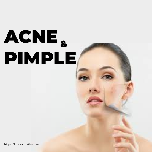 Acne and Pimple