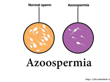 Azoospermia