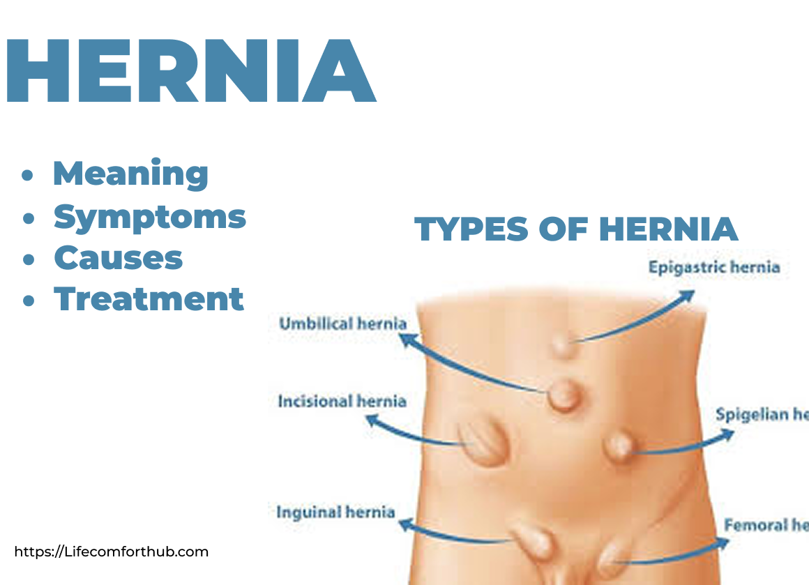 Hernia