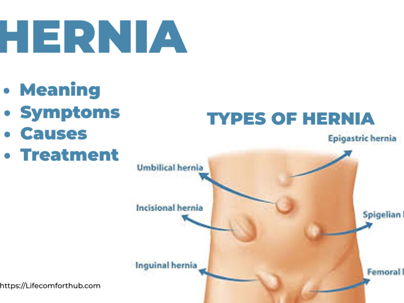 Hernia
